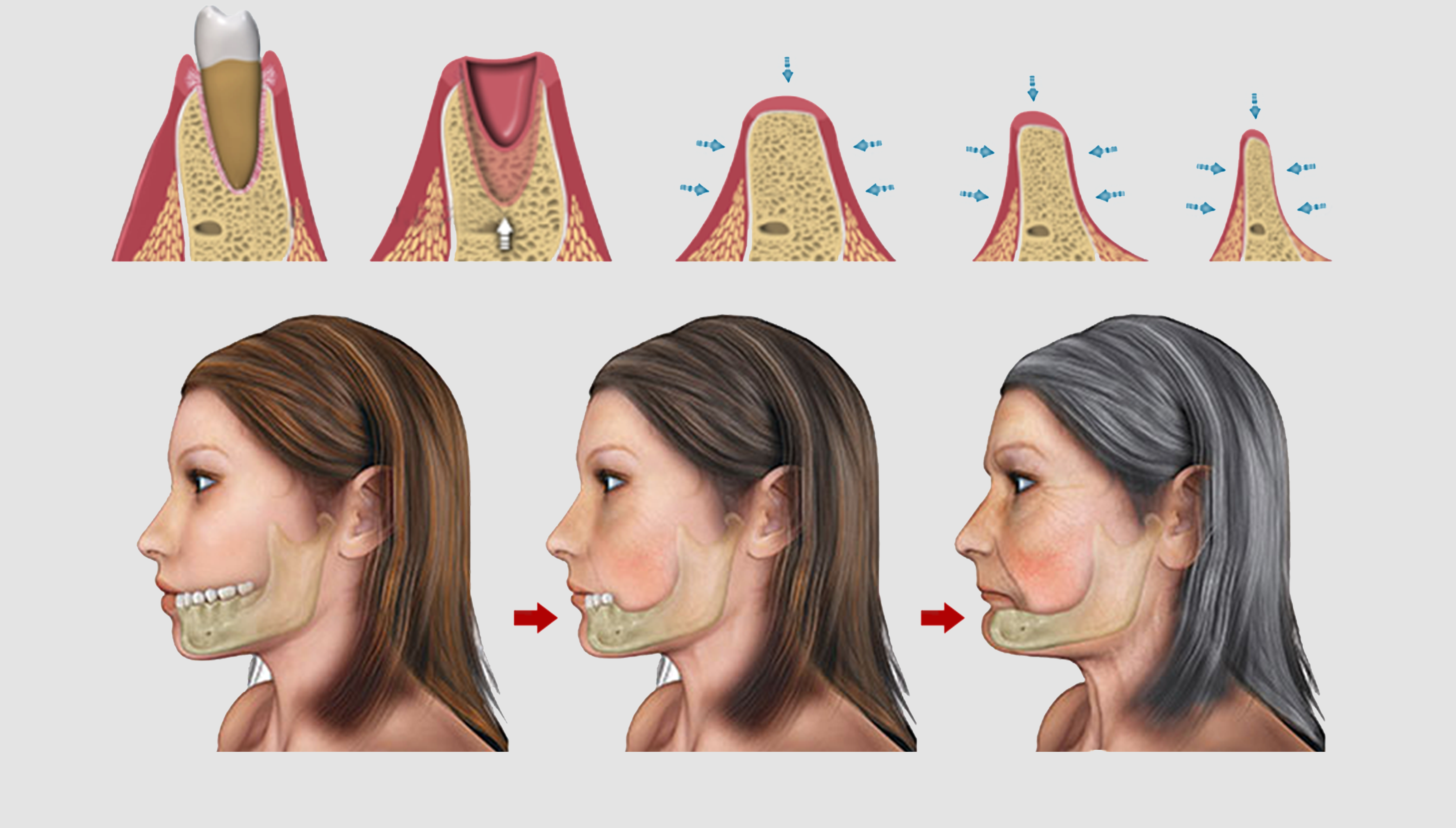 tieu xuong,  mat rang anh 1