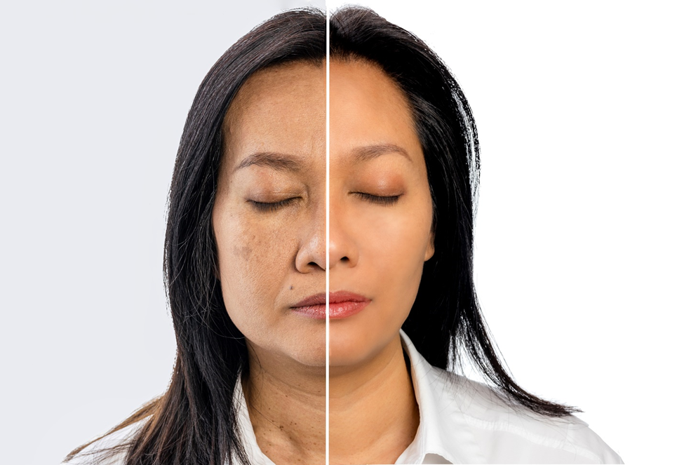 Collagen nước ALFE  ảnh 2 Collagen nuoc ALFE anh 2