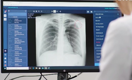 Cong nghe chan doan y te cua Viet Nam co the duoc ung dung toan cau hinh anh