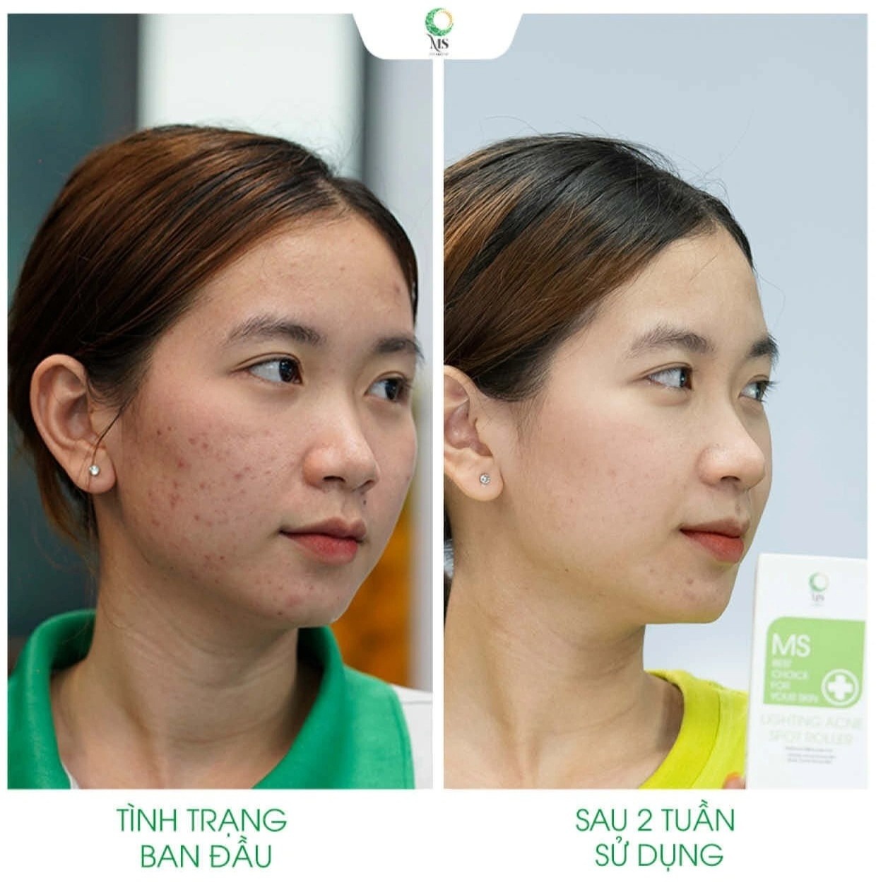 cham soc tham mun anh 3