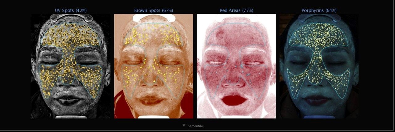 Phong kham Pensilia anh 1