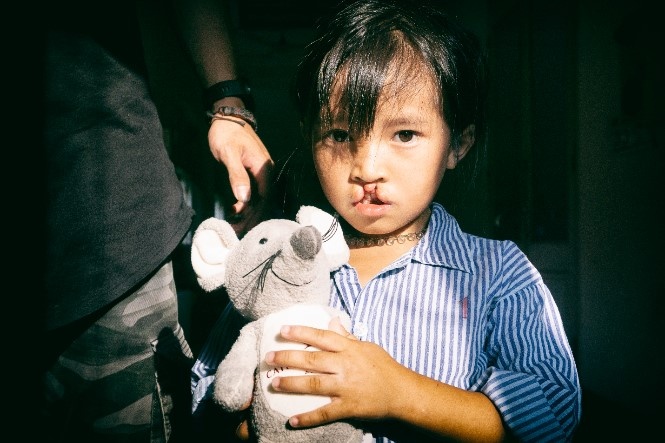 Phau thuan ho ham ech anh 1