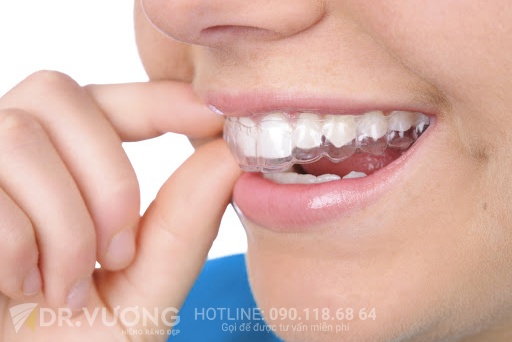 Dr. Vuong,  nieng rang trong suot anh 3