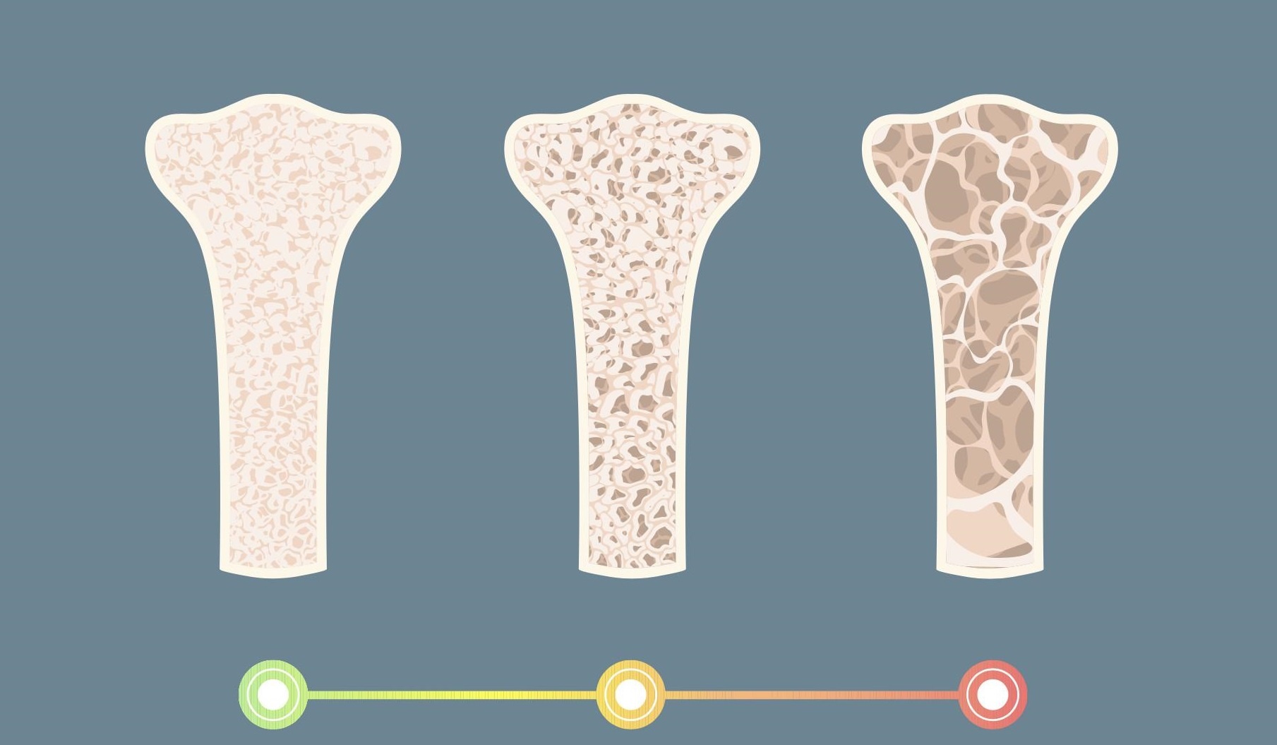 loang xuong,  man kinh anh 1