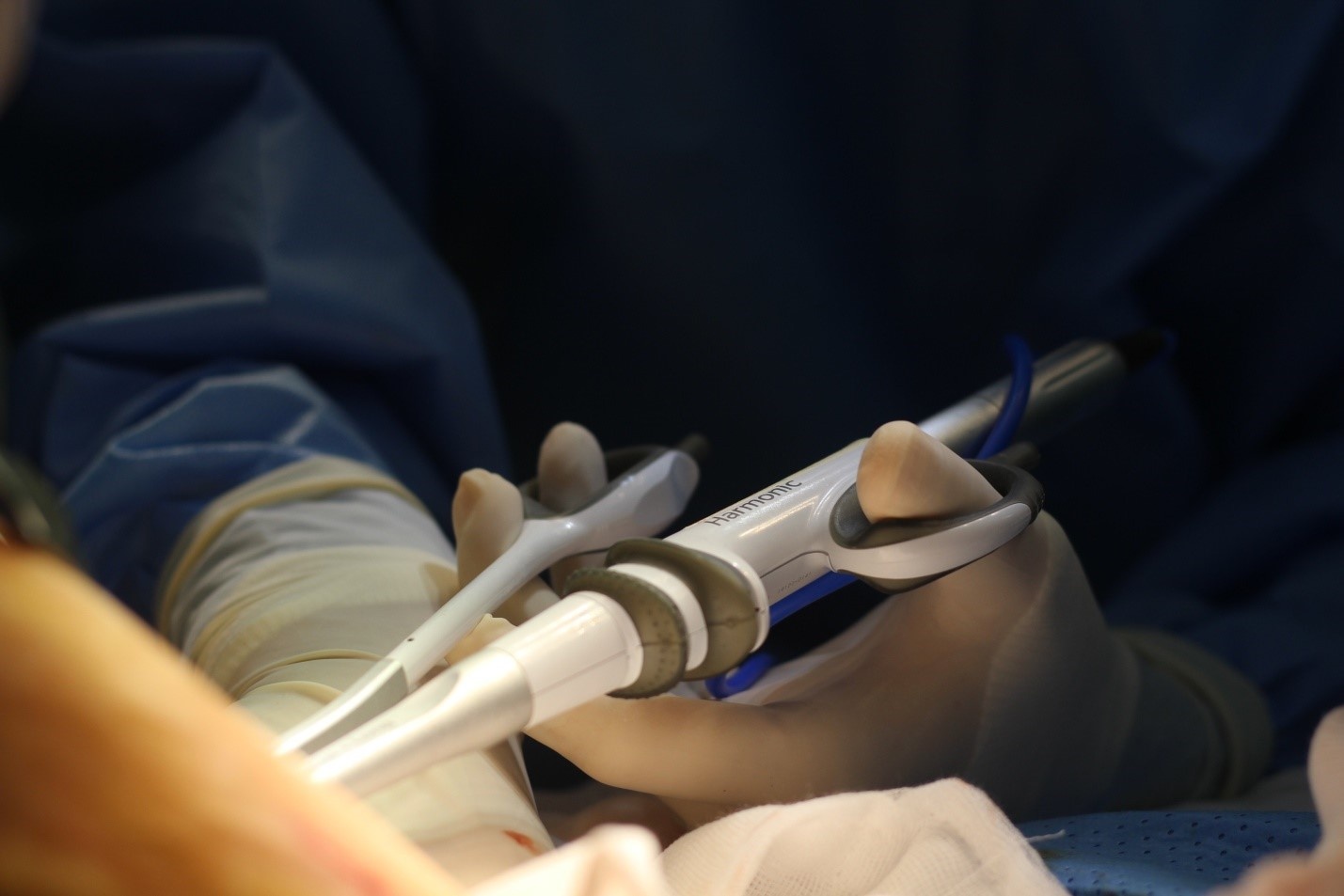 Dieu can biet ve phau thuat tao hinh thanh bung sau sinh hinh anh