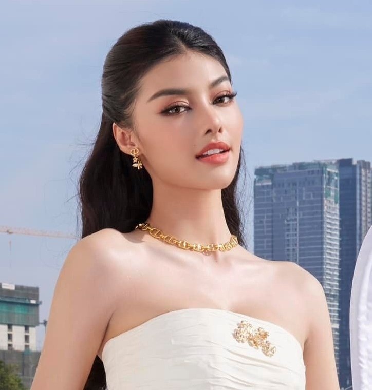 Nhan sac A hau Kieu Loan hau phau thuat tai Benh vien tham my Viet My hinh anh