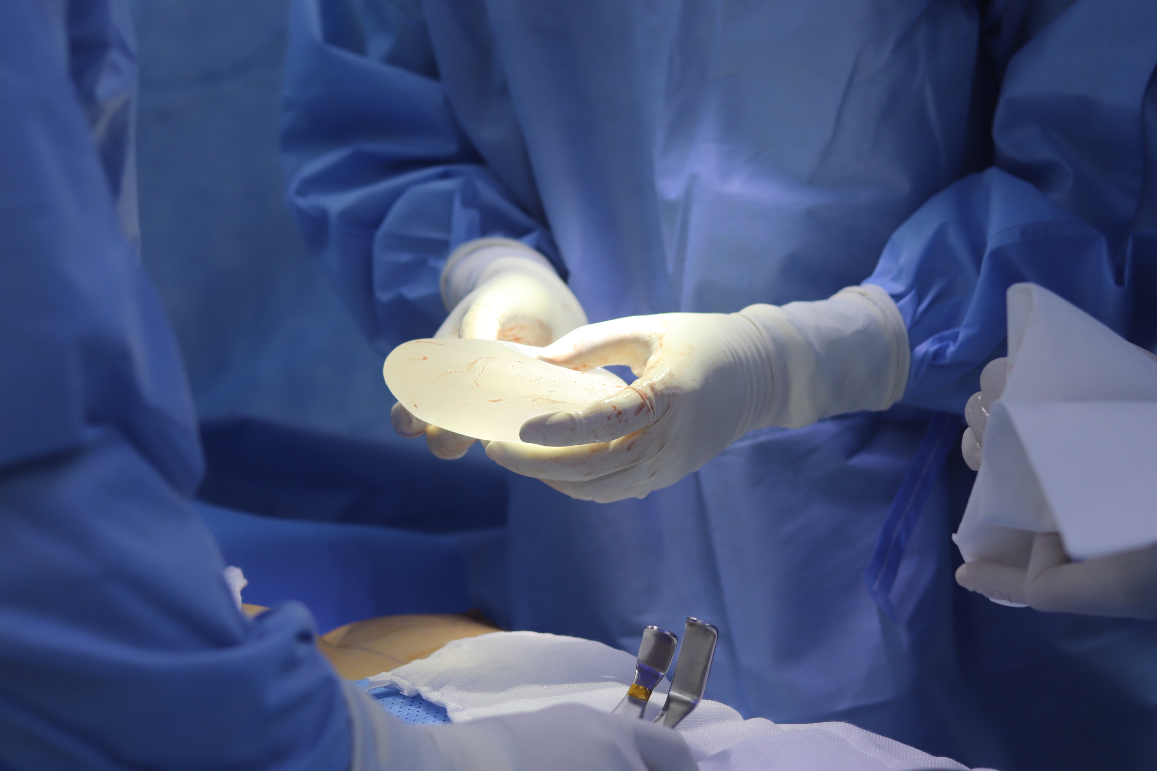 Nguc thong khe anh 2