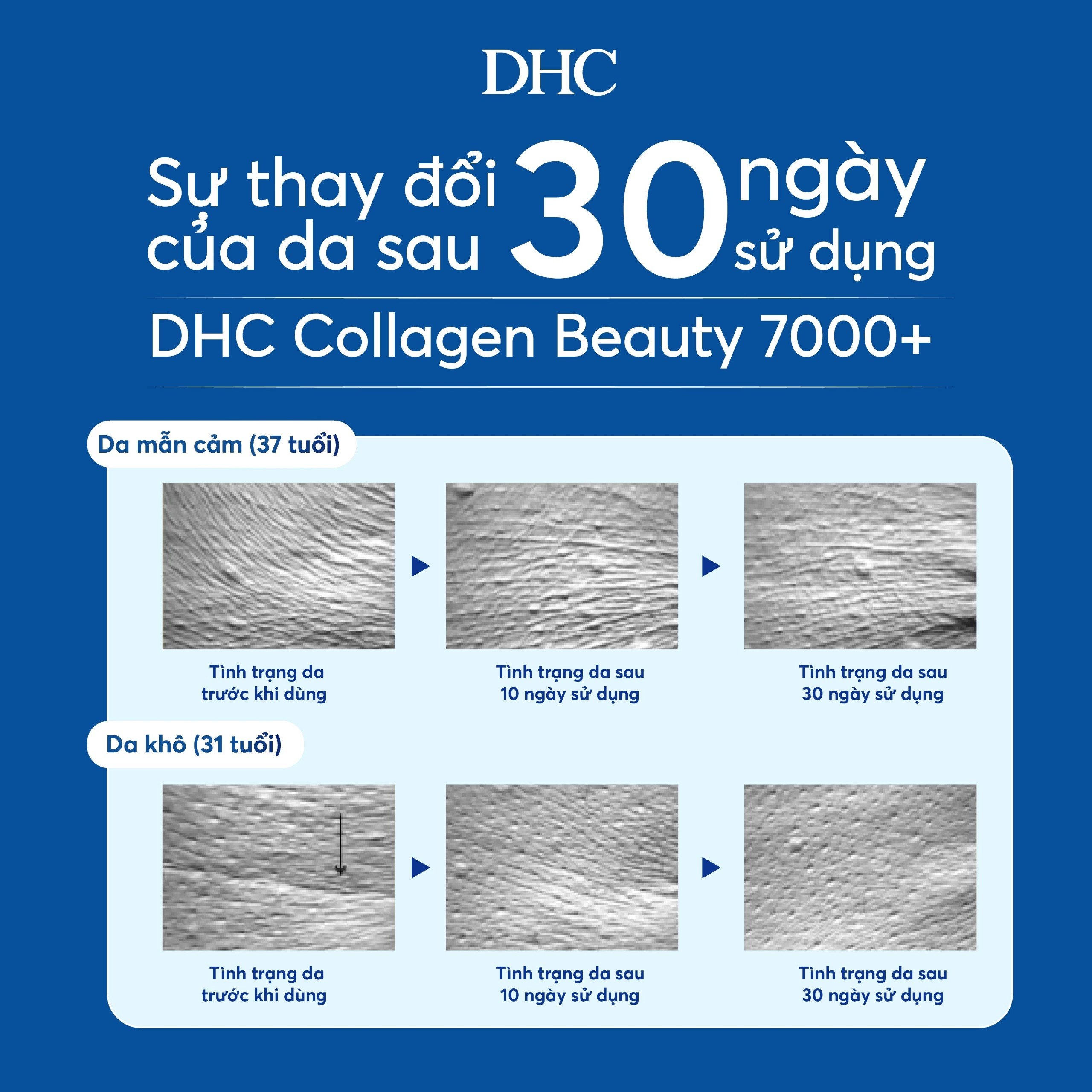 DHC Collagen Beauty  ảnh 5 DHC Collagen Beauty anh 5