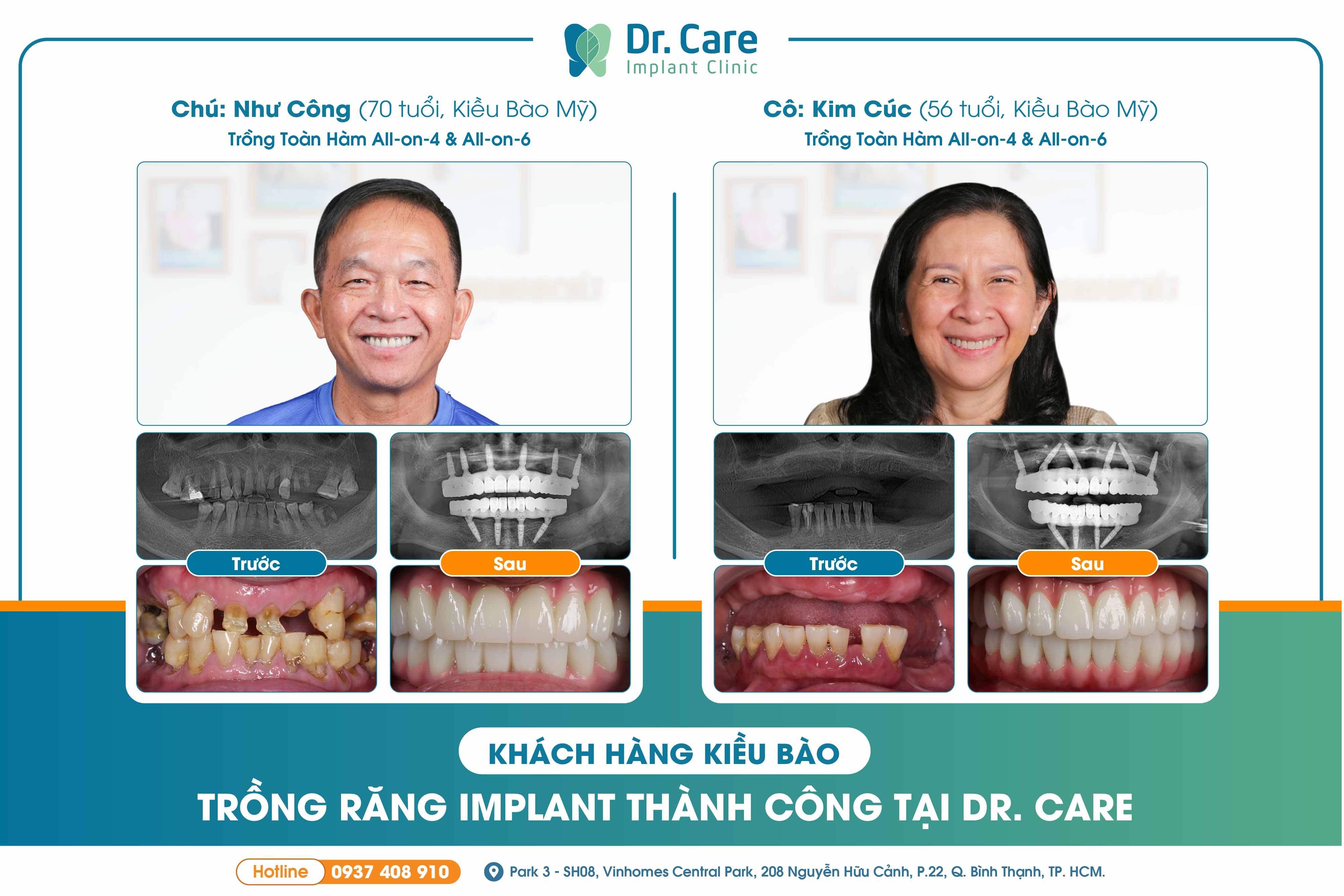 implant anh 5