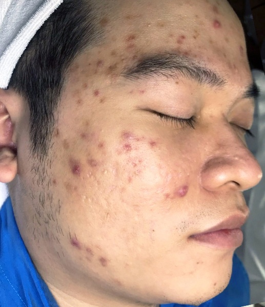 O2 Skin ảnh 2 O2 Skin anh 2