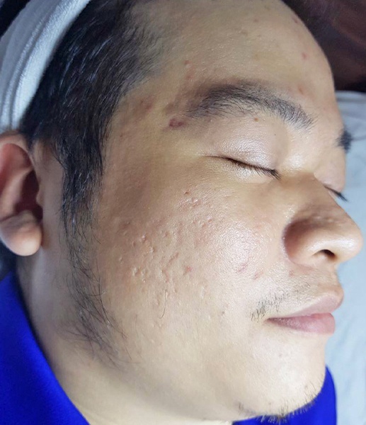 O2 Skin ảnh 3 O2 Skin anh 3