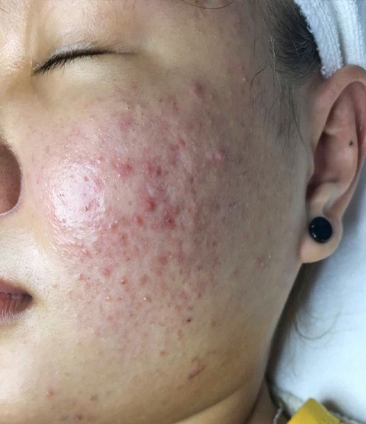 O2 Skin ảnh 4 O2 Skin anh 4