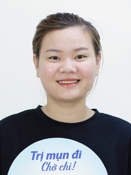 O2 Skin ảnh 5 O2 Skin anh 5