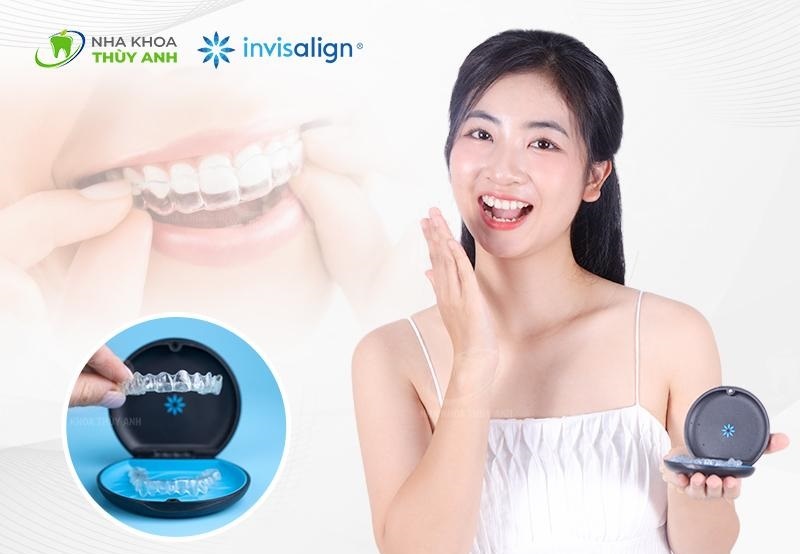 Nguoi Viet ua chuong nieng rang Invisalign - dat xat ra mieng hinh anh