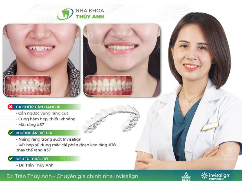 Nha khoa Thuy Anh anh 5