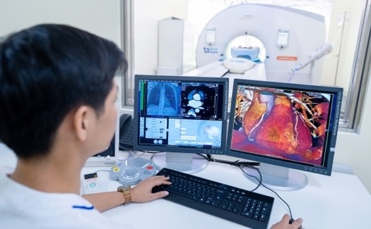 Sieu may chup CT ho tro chan doan chinh xac nho 5 uu the vuot troi hinh anh