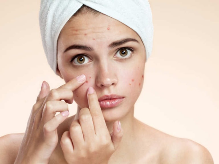 Actidem Derma ảnh 2 Actidem Derma anh 2