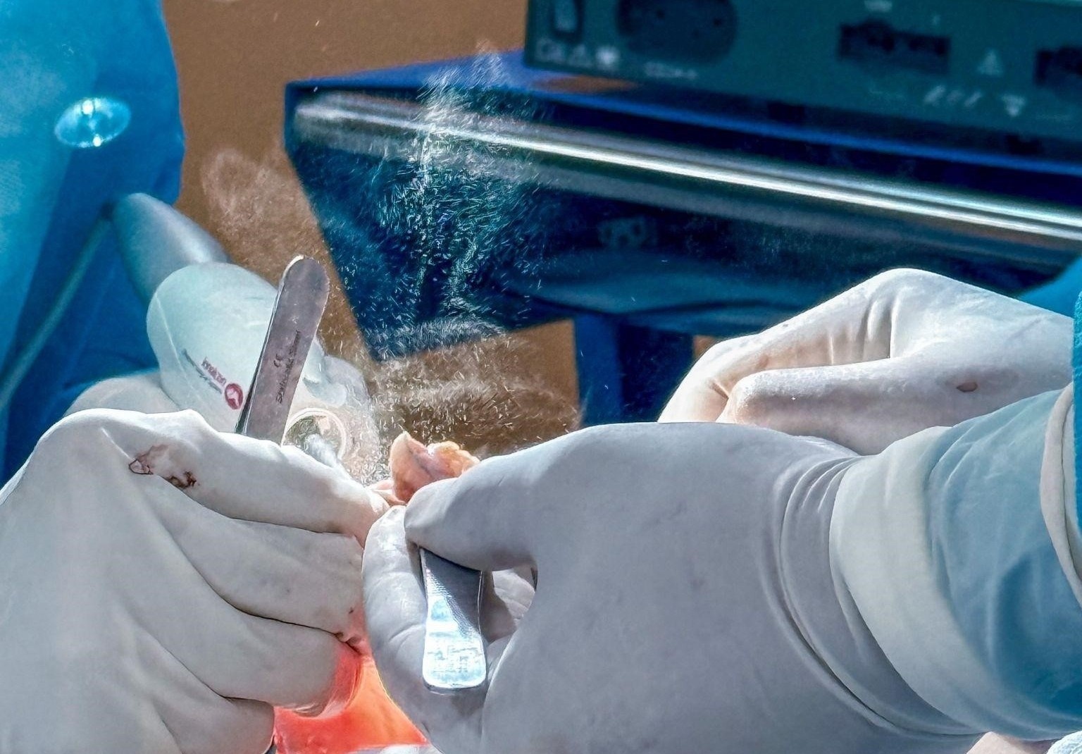 Nguc tai sa tre sau phau thuat tham my hinh anh