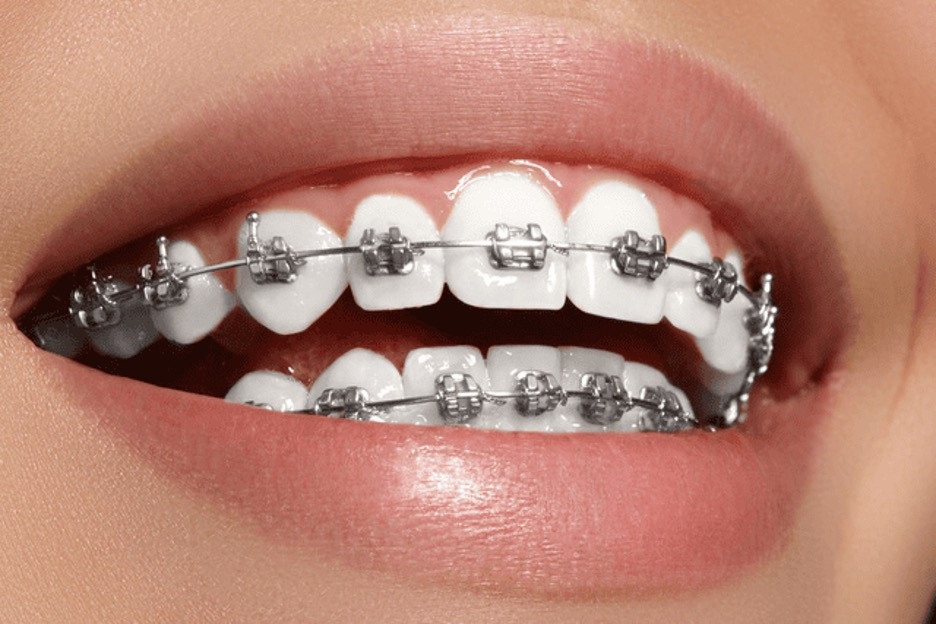 Nha khoa I-Dent anh 1