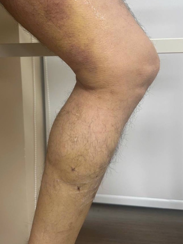 Dr.Vein anh 2