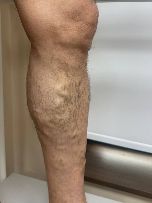 Dr.Vein anh 1