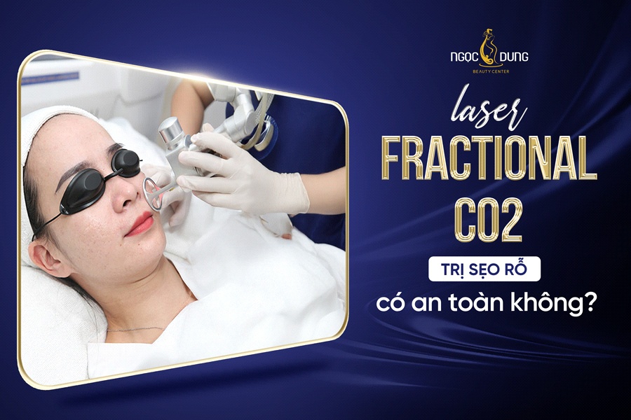 Laser Fractional CO2 tri seo ro co an toan khong? hinh anh