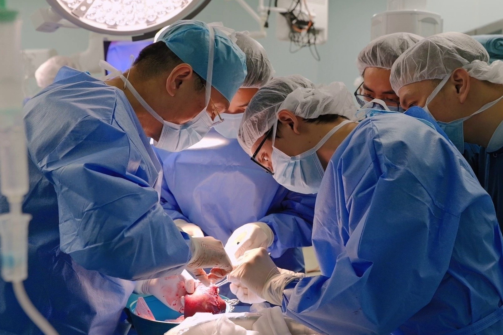 Ky tich ghep gan cho be gai gan 1 tuoi, nang chi 5,3 kg tai Vinmec hinh anh