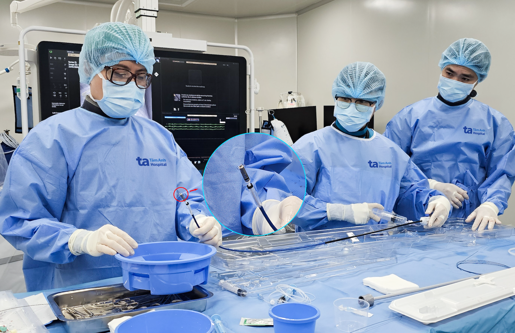 tim mach can thiep anh 2