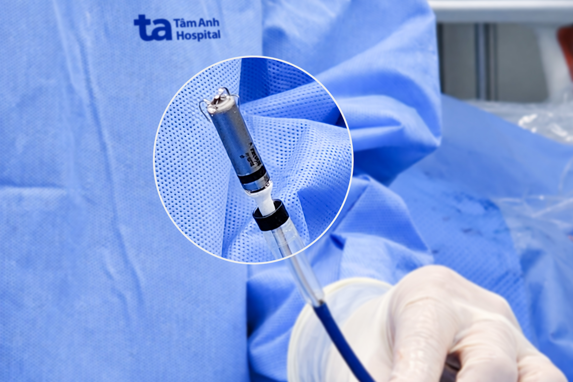 tim mach can thiep anh 3