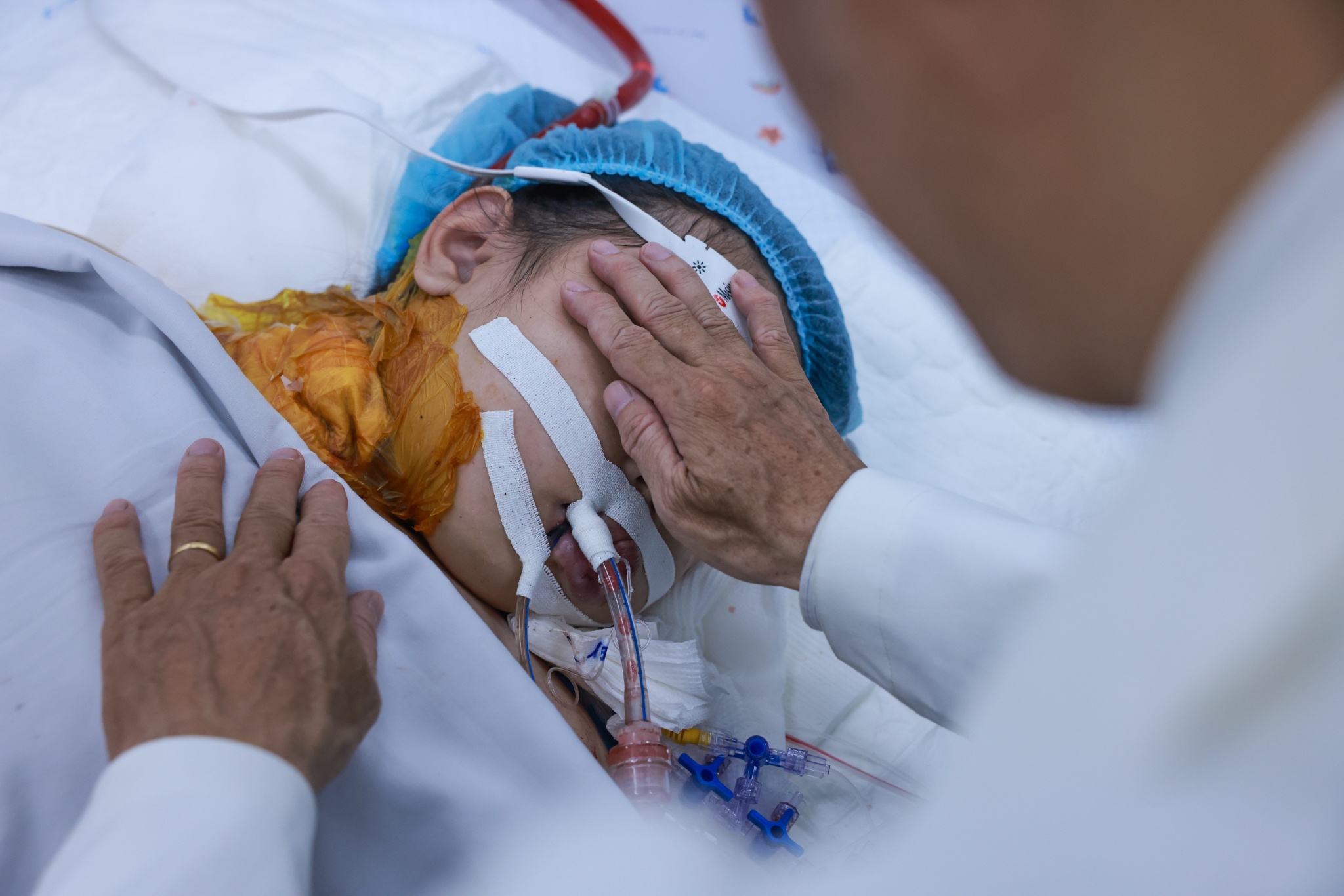 sốt xuất huyết ảnh 12 sot xuat huyet anh 12