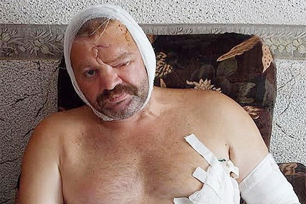 Ngu dan thoat gau tan cong nho de nhac chuong Justin Bieber hinh anh