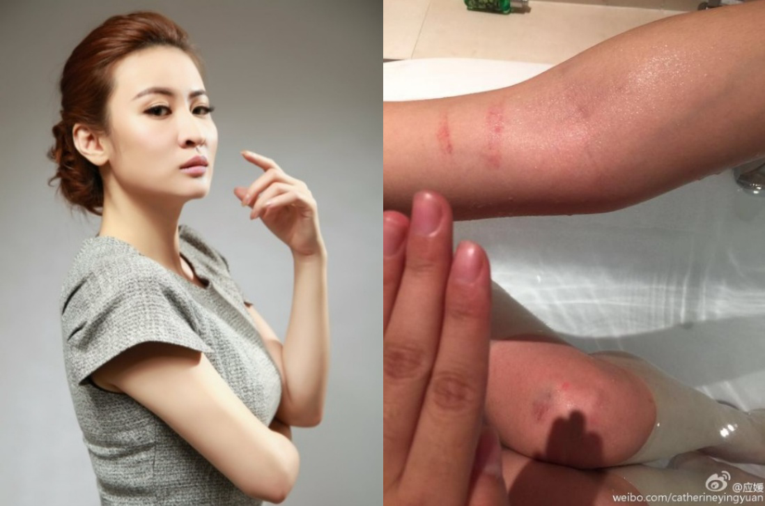 Nguoi dep Hoa ngu phat tan anh bi dao dien ham hai, danh dap hinh anh