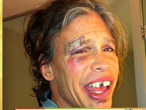 Tai nan cua Steven Tyler khien Aerosmith phai huy show hinh anh