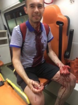 fan Radiohead bi tan cong anh 1