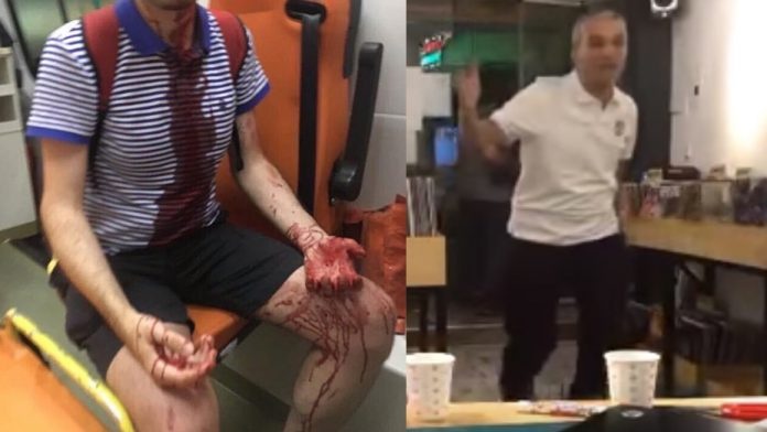 Fan Radiohead tai Tho Nhi Ky bi tan cong dam mau hinh anh