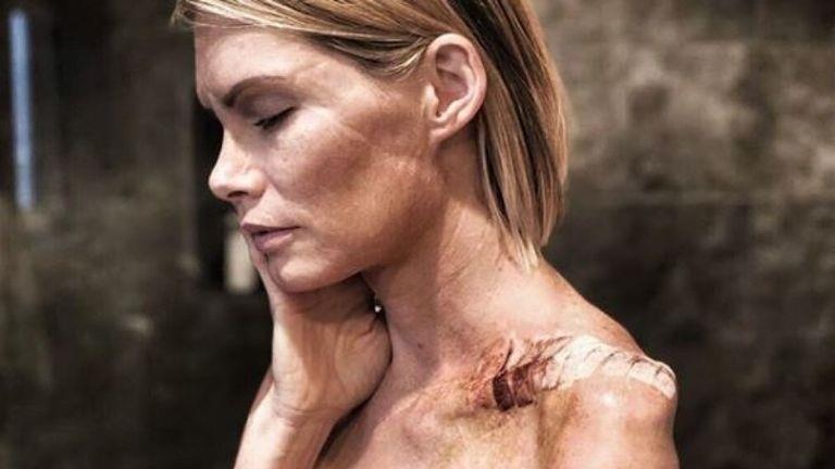 Doan phim bo roi dien vien nga chay mau nao, cat bo tay khi dang quay hinh anh