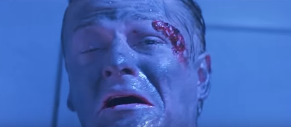 diễn viên chấn thương ảnh 6 dien vien chan thuong anh 6