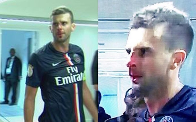 Hanh vi dang len an cua Brandao voi Motta hinh anh