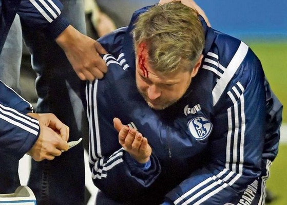 Tro ly cua cuu HLV Chelsea bi nem bat lua Zippo chay mau dau hinh anh