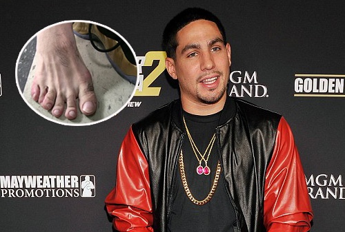 Vo si ‘doc co cau bai’ nho ban chan 6 ngon hinh anh