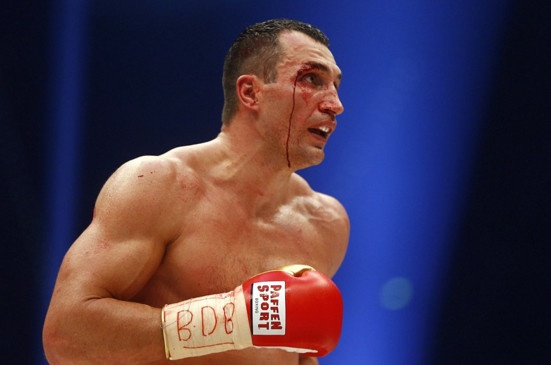 'Tien si bua thep' Klitschko mat dai vo dich sau 9 nam hinh anh