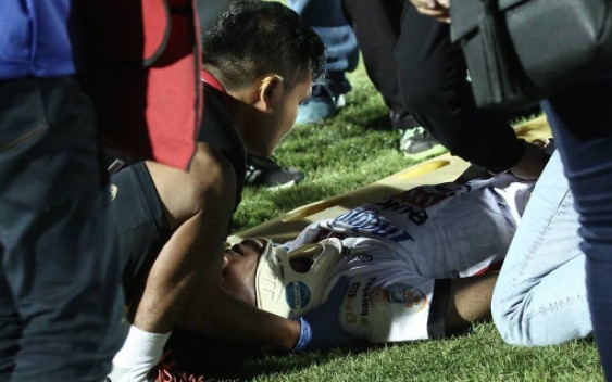 Cau thu U19 Indonesia lo ngai gay xuong co sau vu loan da hinh anh