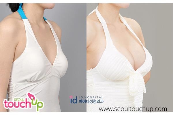 xu hướng phẫu thuật thẩm mỹ ảnh 9 xu huong phau thuat tham my anh 9