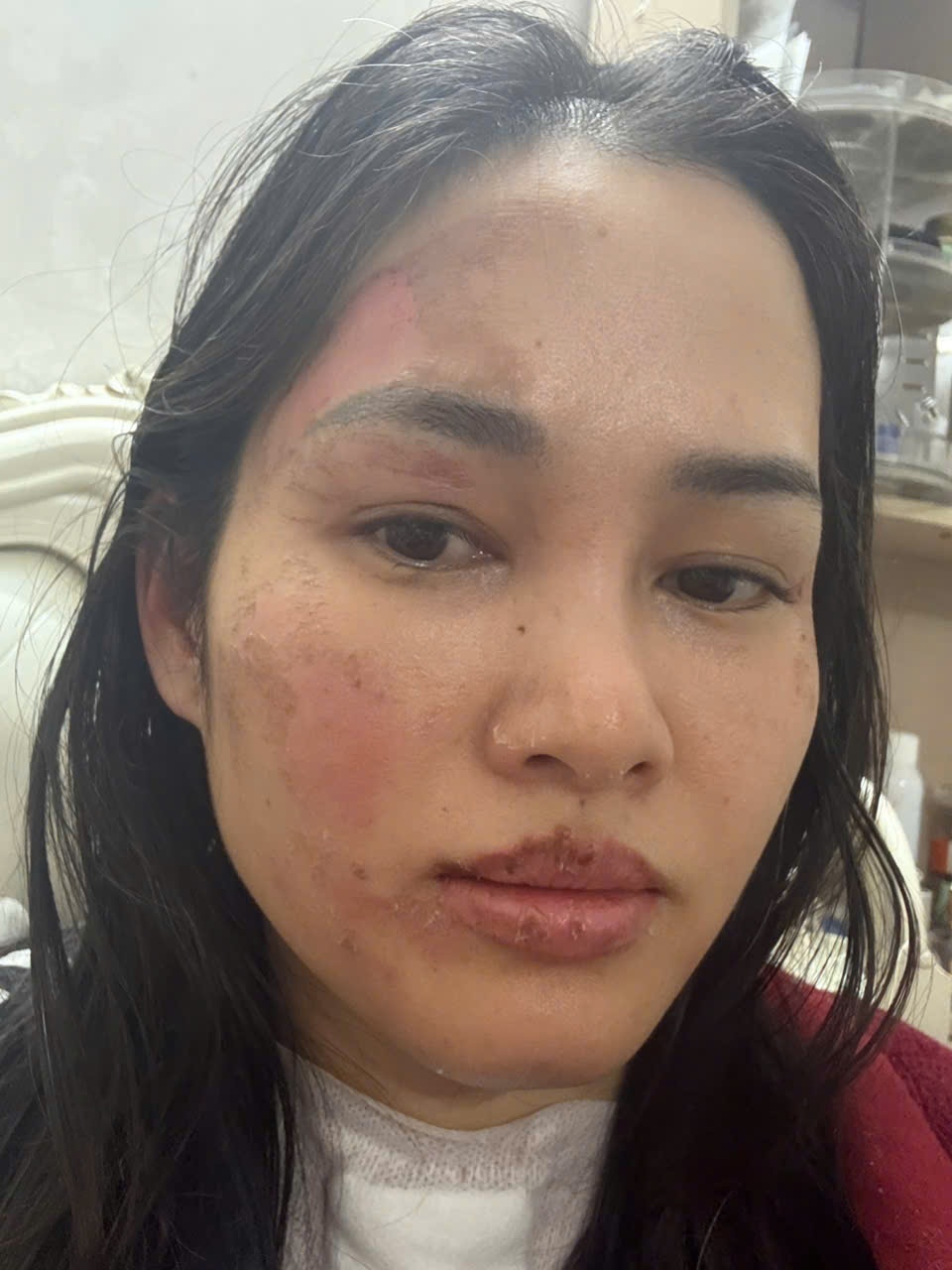 bi bong do bong bay anh 1