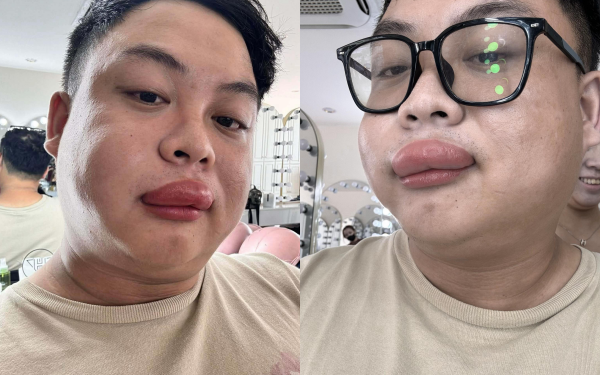 Bi hai co dau va tho make up o Vinh Long bi ong chich sung vu mat hinh anh