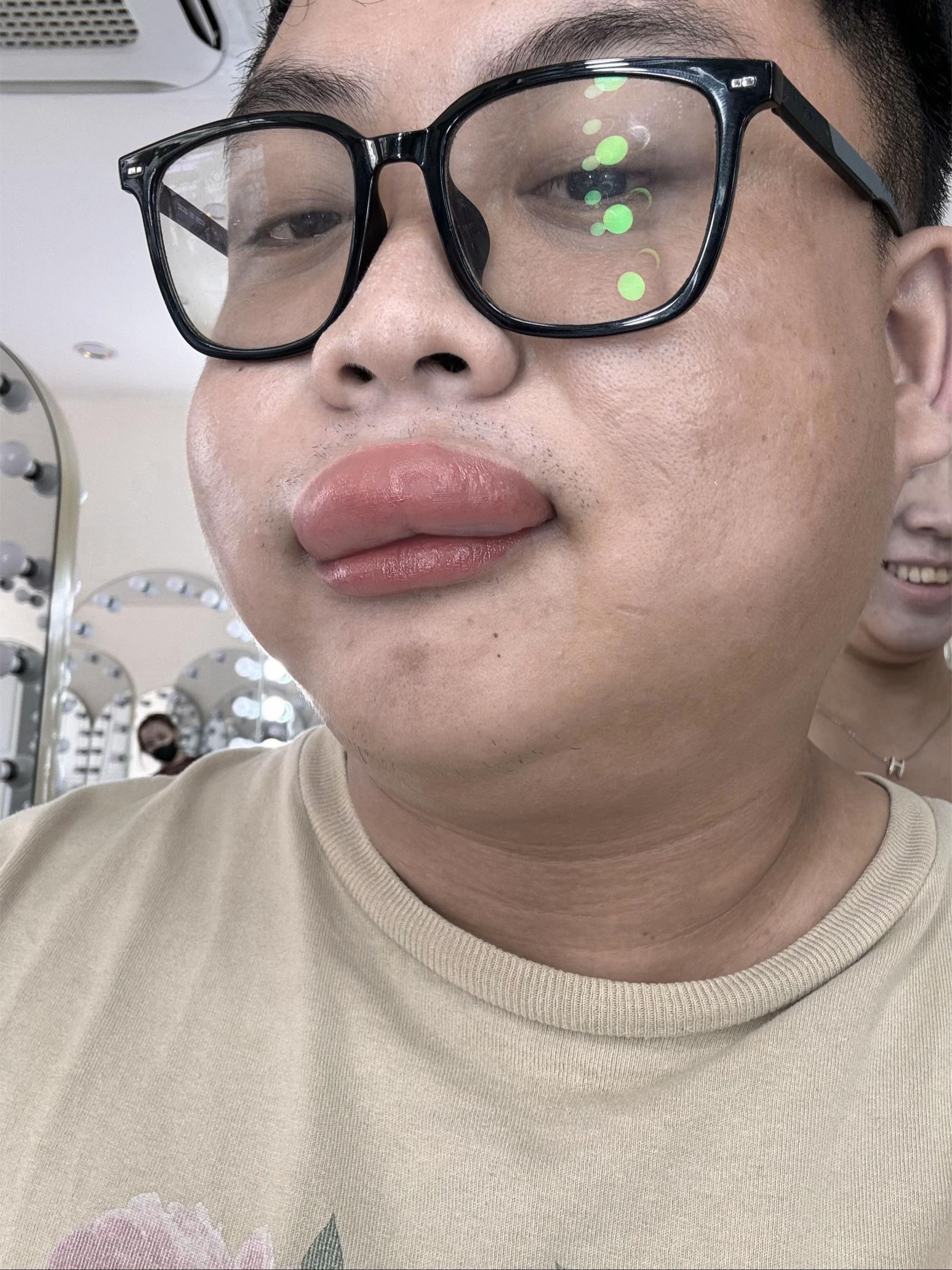 ong dot co dau anh 2