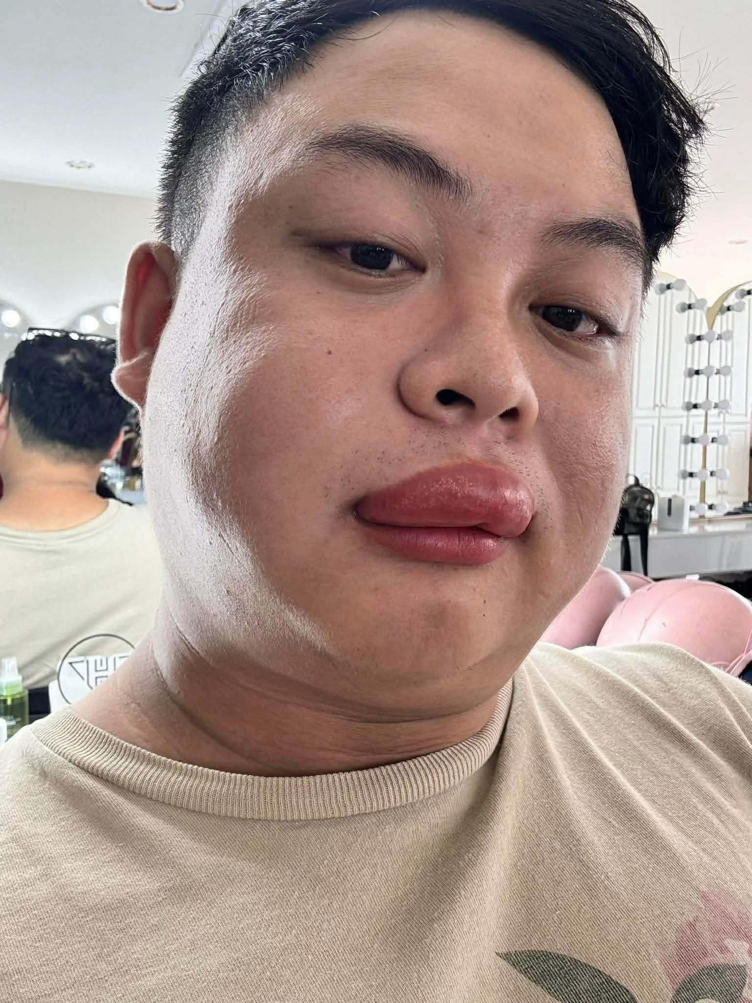 ong dot co dau anh 1