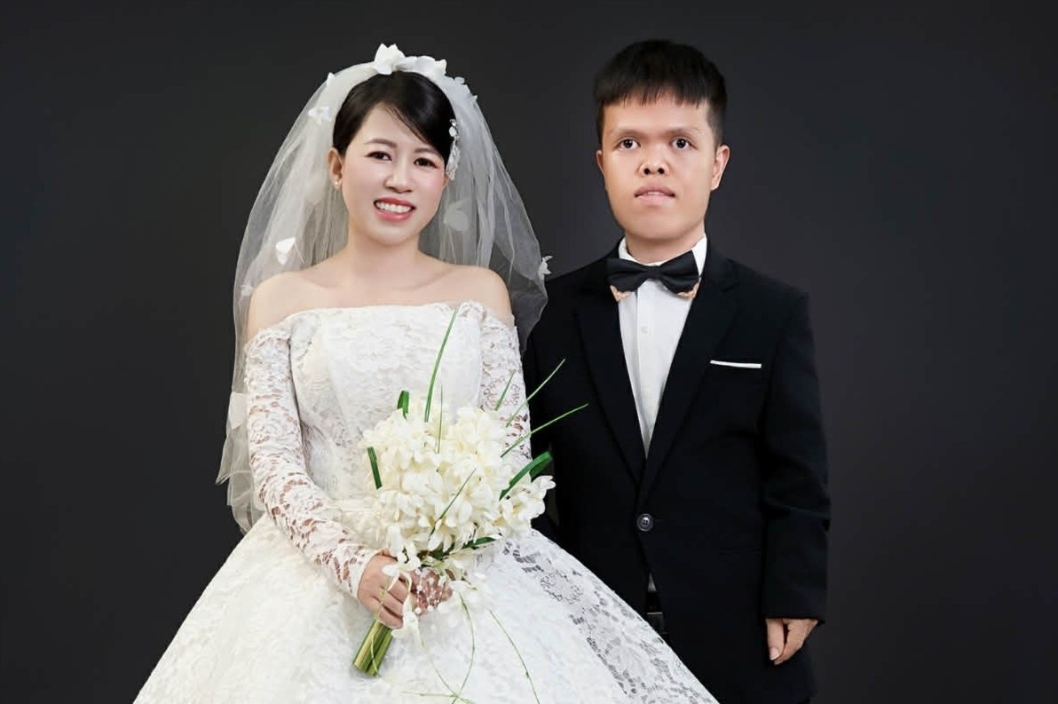Tinh co chung lop, chang trai 1,3 m ben duyen co gai bi cat 1/3 chan hinh anh