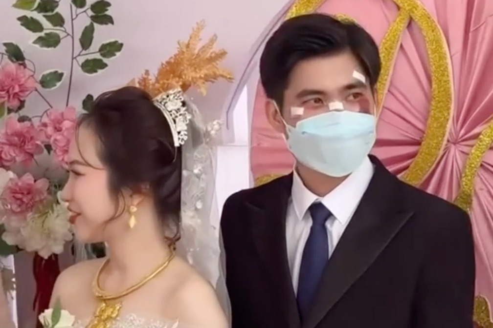 Chu re deo khau trang che mat day vet thuong trong ngay cuoi hinh anh