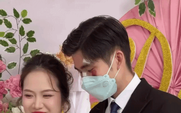 Chu re deo khau trang che mat day vet thuong trong ngay cuoi hinh anh